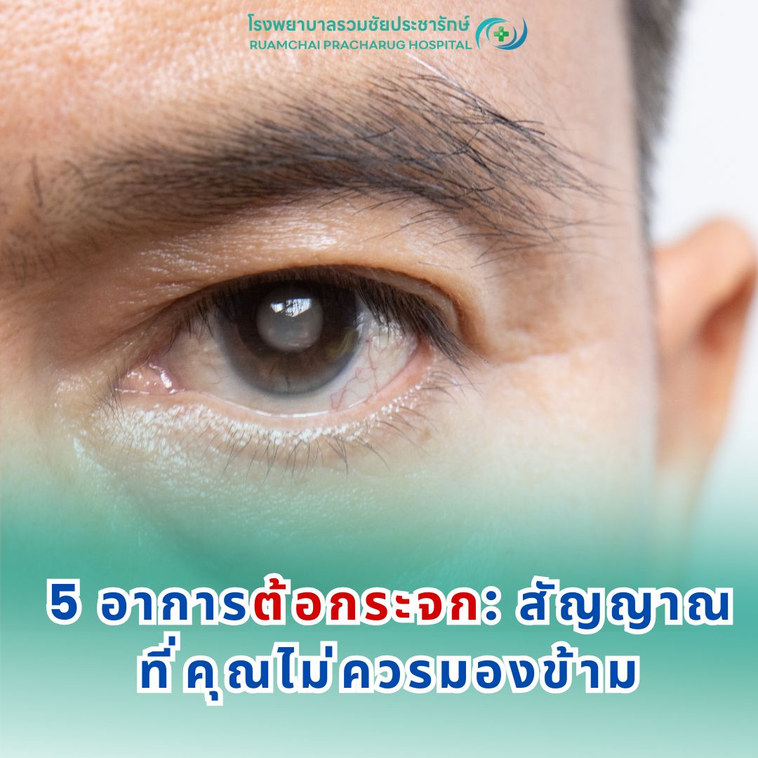 ตาต้อกระจก